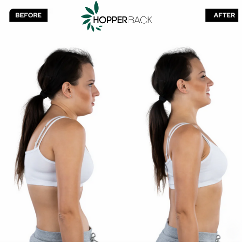 HopperBack™ Posture Corrector